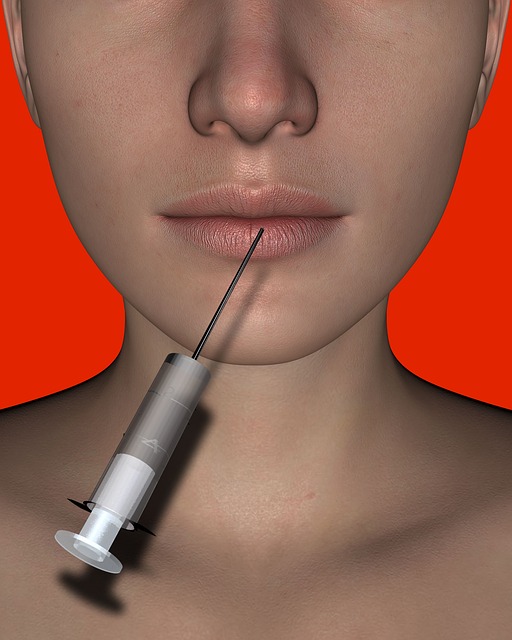 lip filler injection